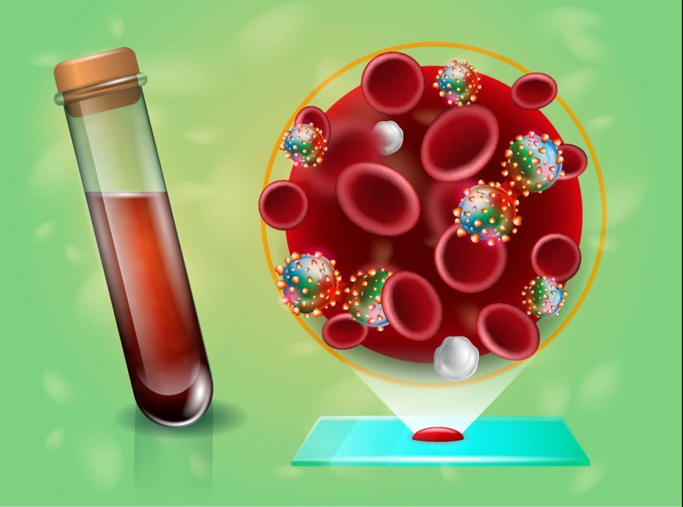 A New Blood Test Detected More Than 50 Types Of Cancer As Well As Their ...