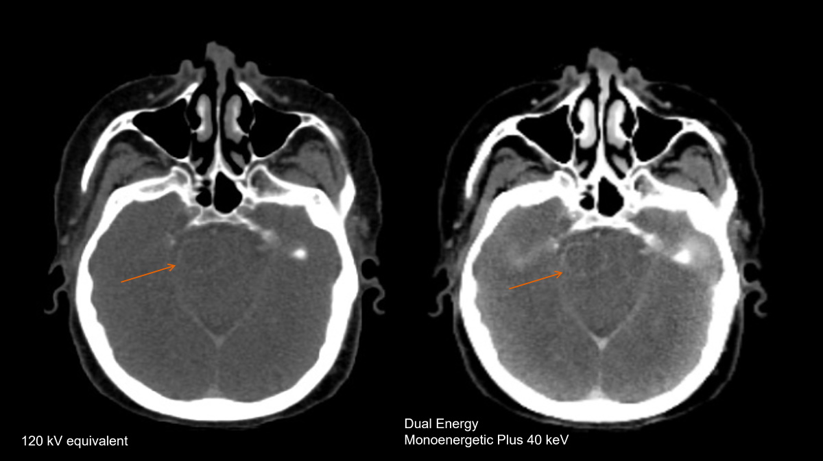 Imaging innovation sharpens the view for radiotherapy clinics - DLIT