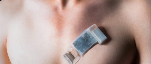 Wireless ultrasound for deep-tissue cardiac monitoring while moving - Innovation Toronto