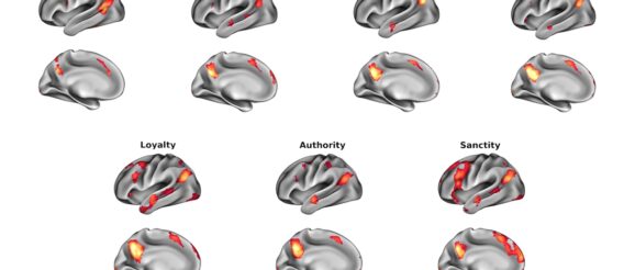 Do distinct moral categories have an underlying neurologic basis? - Innovation Toronto