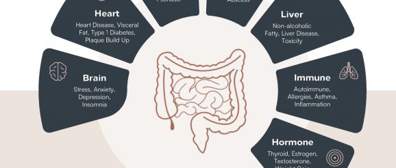 Gut microbiome is an innovation frontier with major health, business implications